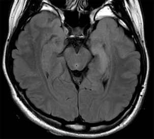 MRI検査イメージ