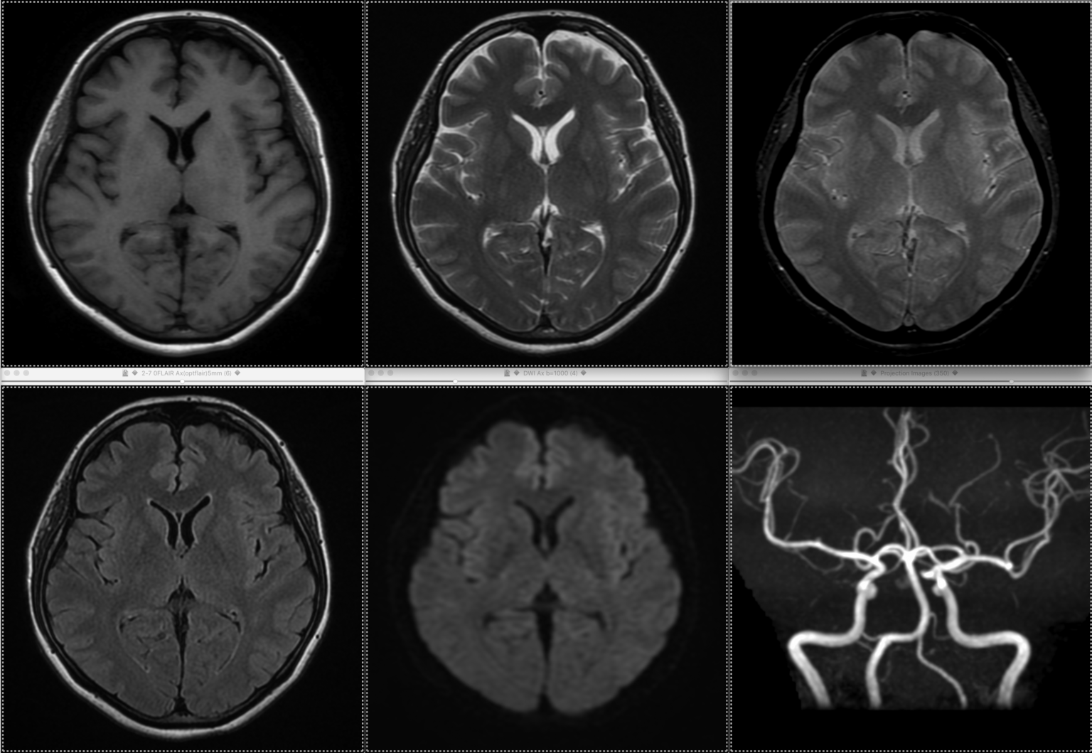脳MRIとは | 福岡の脳神経外科 - はしぐち脳神経クリニック